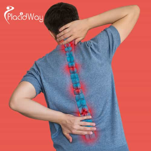 Filipinos Are Finding Spinal Arthritis Relief with Stem Cells in Tokyo